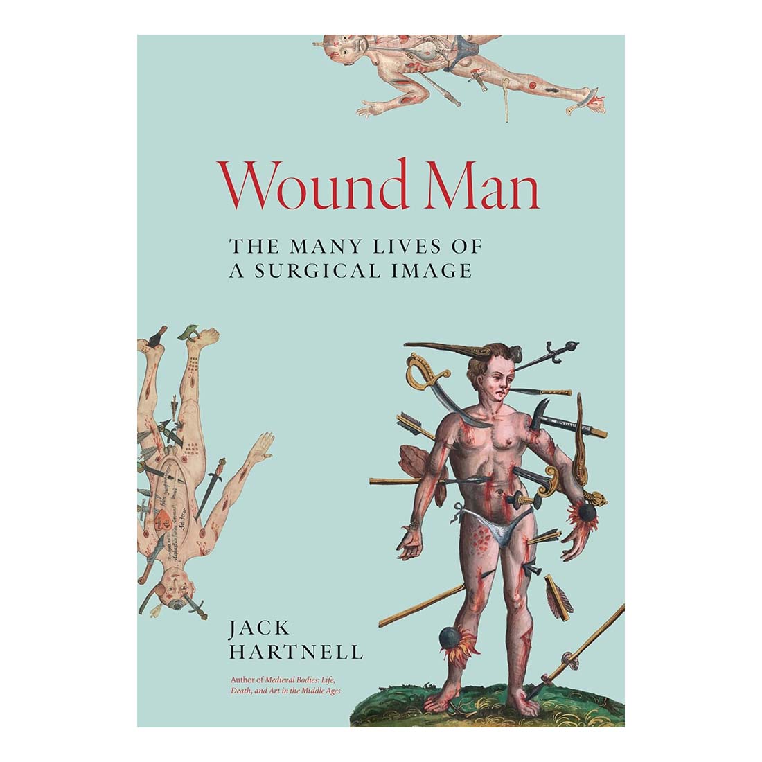 Wound Man: The Many Lives of a Surgical Image